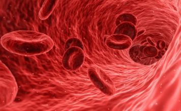 Venska tromboza u trudnoći