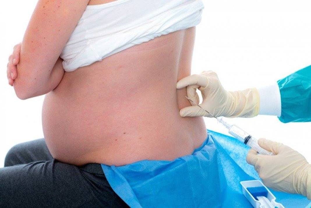 epidural radosnica skola za trudnice banja luka mamaklik