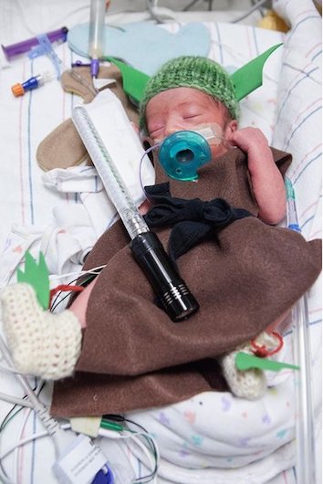 Prijevremeno rođene bebe: Superheroji iz inkubatora (FOTO)