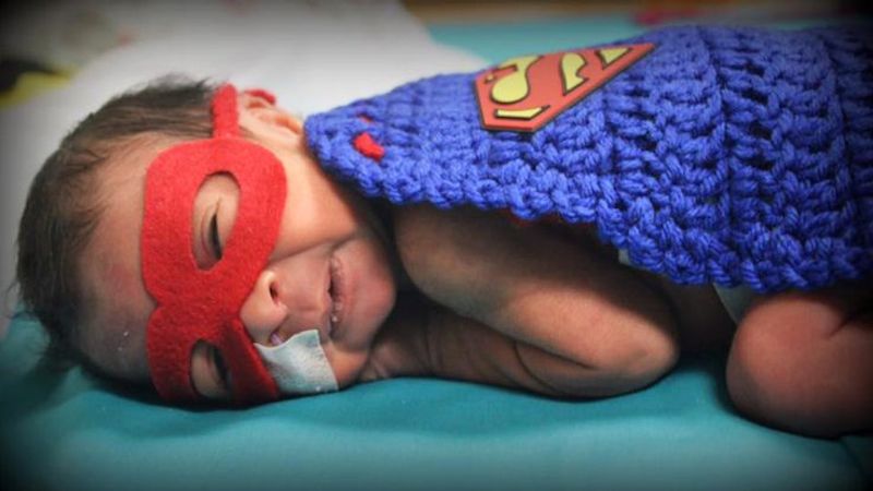 Prijevremeno rođene bebe: Superheroji iz inkubatora (FOTO)