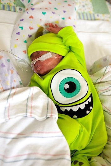 Prijevremeno rođene bebe: Superheroji iz inkubatora (FOTO)