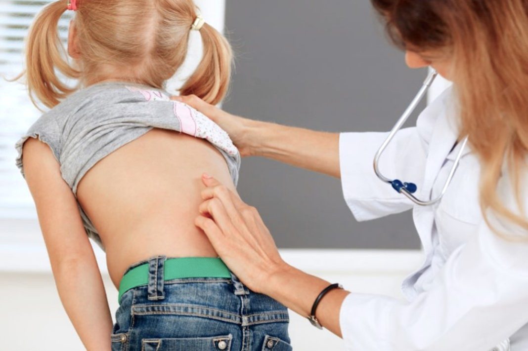 deformiteti kicme kod djaka