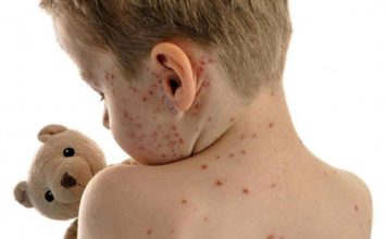 Vodene ospice napunile ambulante u RS