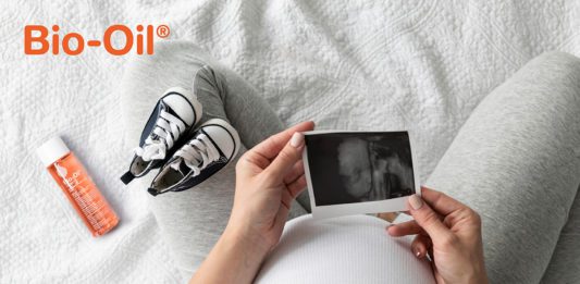 Bio Oil ulje protiv strija u trudnoci mamaklik.com
