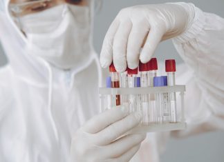 serološko testiranje na covid-19 u BiH