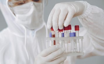 serološko testiranje na covid-19 u BiH