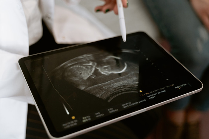 Indikacije za neinvazivno prenatalno testiranje: Ultrazvučni pregled